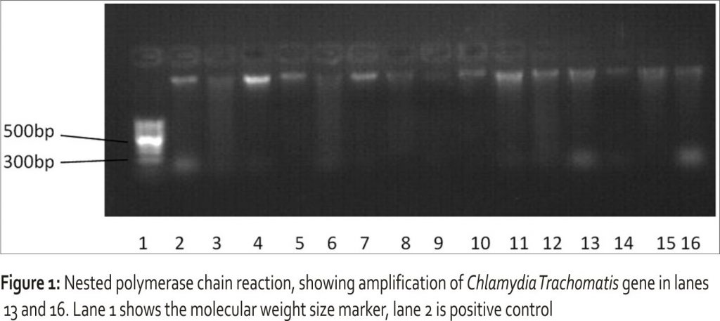 Figure 1: Nested polymerase chain reaction, showing amplification of Chlamydia Trachomatis gene in lanes 13 and 16. Lane 1 shows the molecular weight size marker, lane 2 is positive control