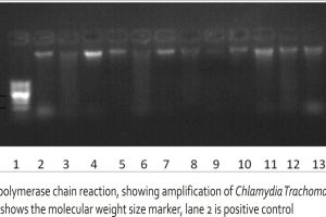 Figure 1: Nested polymerase chain reaction, showing amplification of Chlamydia Trachomatis gene in lanes 13 and 16. Lane 1 shows the molecular weight size marker, lane 2 is positive control