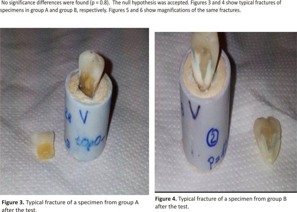 No significance differences were found (p = 0.8). The null hypothesis was accepted. Figures 3 and 4 show typical fractures of specimens in group A and group B, respectively. Figures 5 and 6 show magnifications of the same fractures.