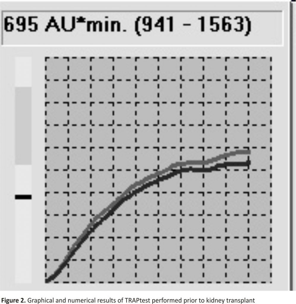 Figure 2. Graphical and numerical results of TRAPtest performed prior to kidney transplant