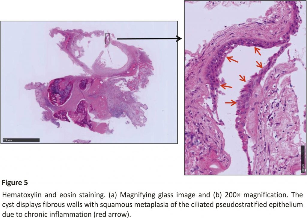 Hematoxylin and eosin staining. (a) Magnifying glass image and (b) 200× magnification.