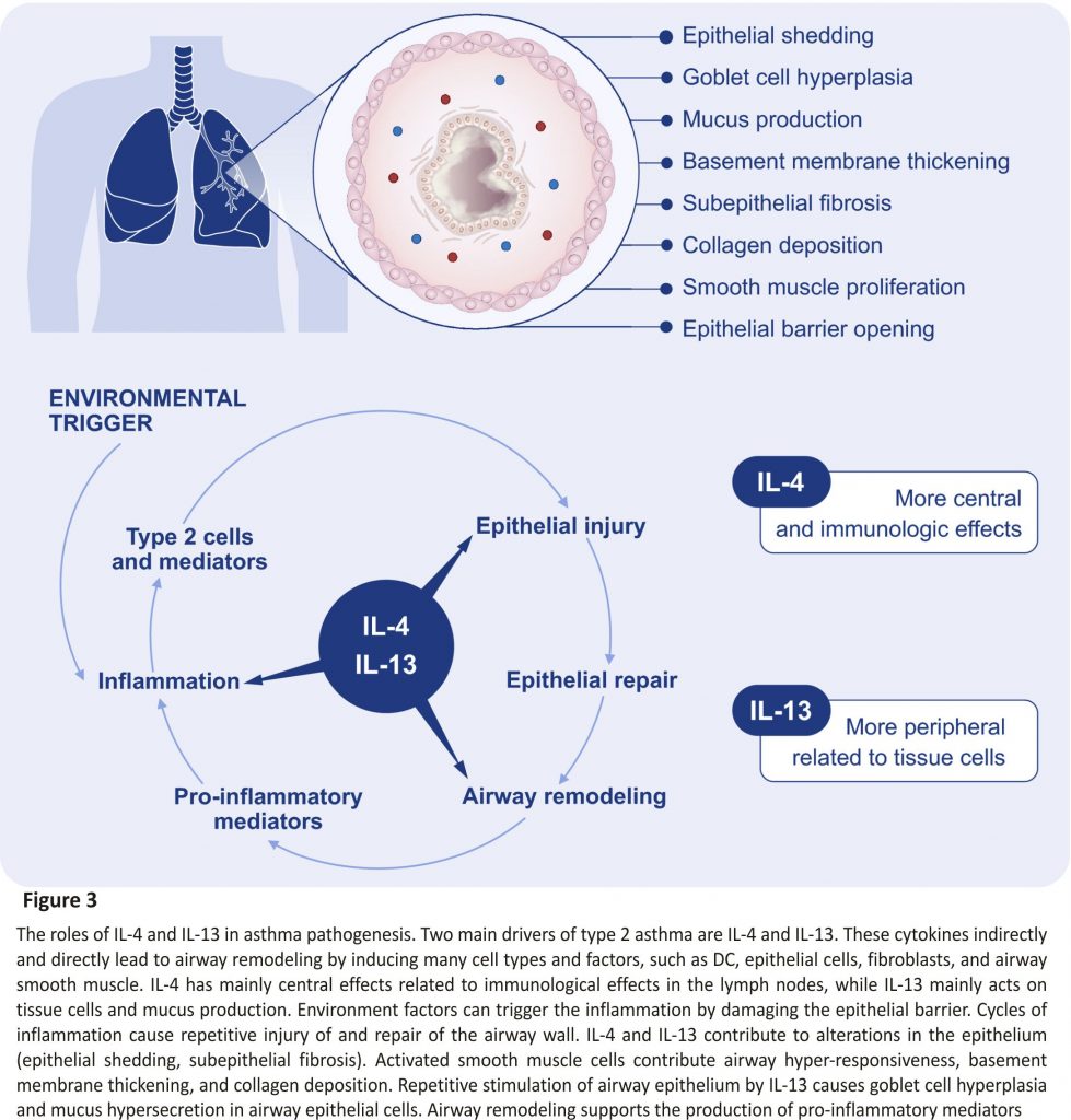 The roles of IL‐4 and IL‐13 in asthma pathogenesis.
