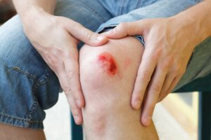 injuries to stop bleeding