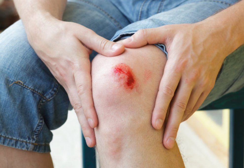 injuries to stop bleeding