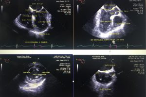 4 basic views to use in the patient who presents in cardiac arrest Image