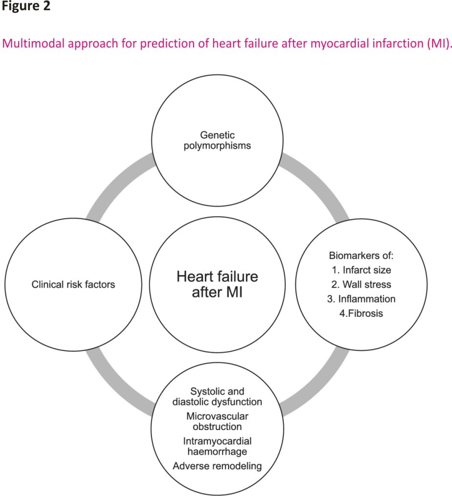 Heart failure after myocardial infarction: incidence and predictors ...