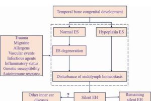 Figure 2. A pattern diagram of Meniere’s disease occurrence. ES, endolymphatic sac; EH, endolymphatic hydrops.