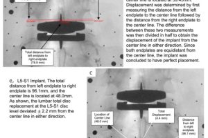 Evaluation of implant placement.