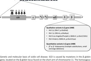 Genetic and molecular basis of sickle cell disease.