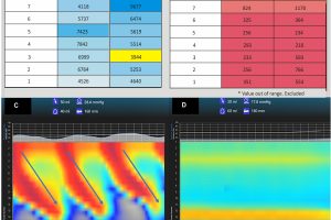 Tracings from mucosal impedance and functional luminal imaging probe (FLIP) technology.