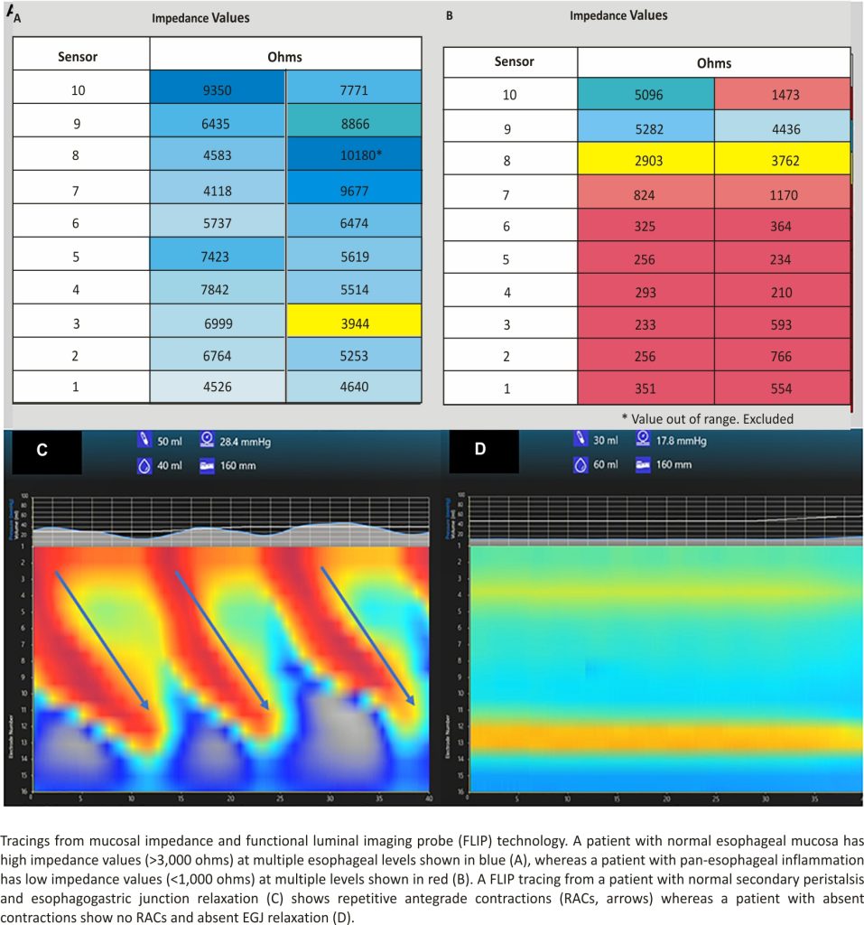 Tracings from mucosal impedance and functional luminal imaging probe (FLIP) technology.