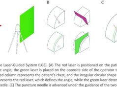 Novel Laser System-Assisted CT-Guided Percutaneous Transthoracic Lung Biopsy in Patients with COPD Combined with Pulmonary Nodules