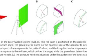 Novel Laser System-Assisted CT-Guided Percutaneous Transthoracic Lung Biopsy in Patients with COPD Combined with Pulmonary Nodules