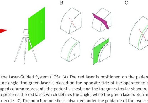Novel Laser System-Assisted CT-Guided Percutaneous Transthoracic Lung Biopsy in Patients with COPD Combined with Pulmonary Nodules