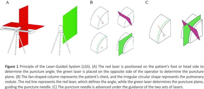 Novel Laser System-Assisted CT-Guided Percutaneous Transthoracic Lung Biopsy in Patients with COPD Combined with Pulmonary Nodules