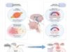 Chronic Cough Hypersensitivity as a Neuropathic Disorder: Implications for Management and New Treatments