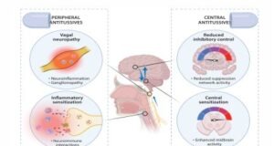 Chronic Cough Hypersensitivity as a Neuropathic Disorder: Implications for Management and New Treatments