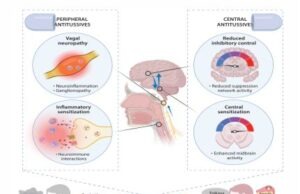 Chronic Cough Hypersensitivity as a Neuropathic Disorder: Implications for Management and New Treatments